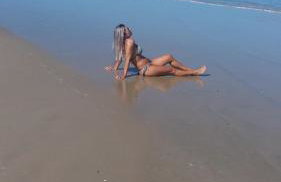 Apartamentos Imbe - Foto 14